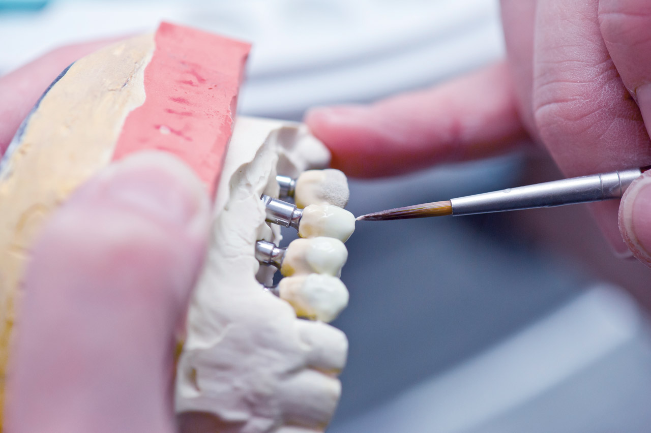 Les Laboratoires Dentaires Gourdy / Prothèses conjointes
